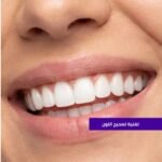 ⁦هاي سمايل معجون أسنان V34 لتصحيح اللون - 100جم⁩ - الصورة ⁦4⁩