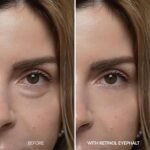 ⁦دكتور ميلاكسين كريم ريتينول آيفالت لحقيبة العين⁩ - الصورة ⁦4⁩